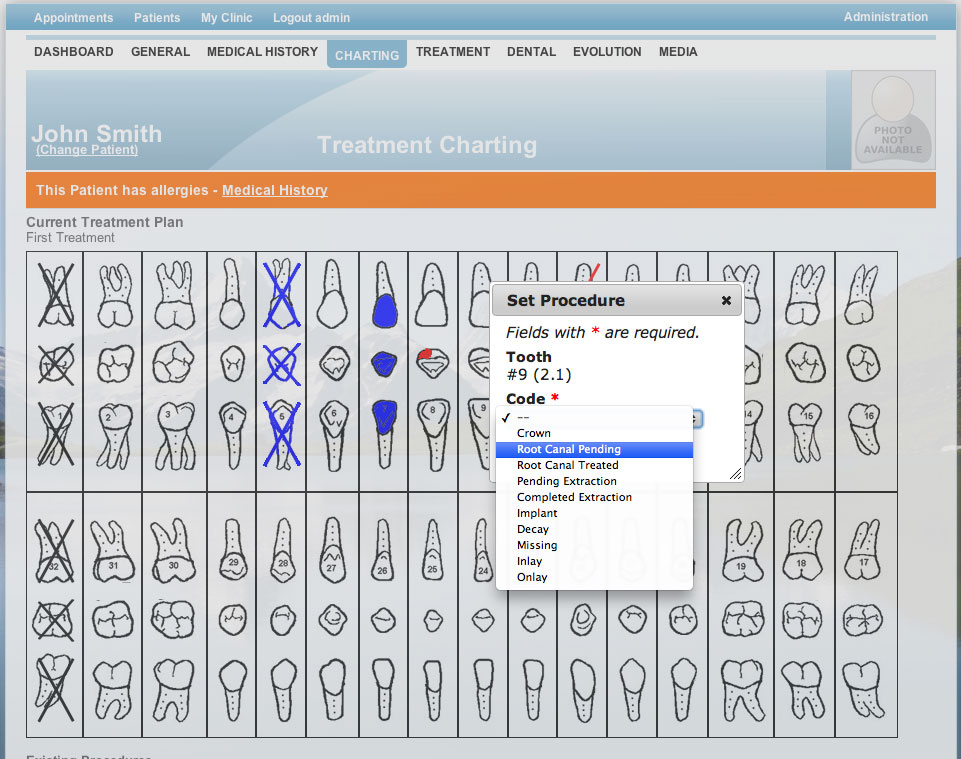 Dental Charting Symbols